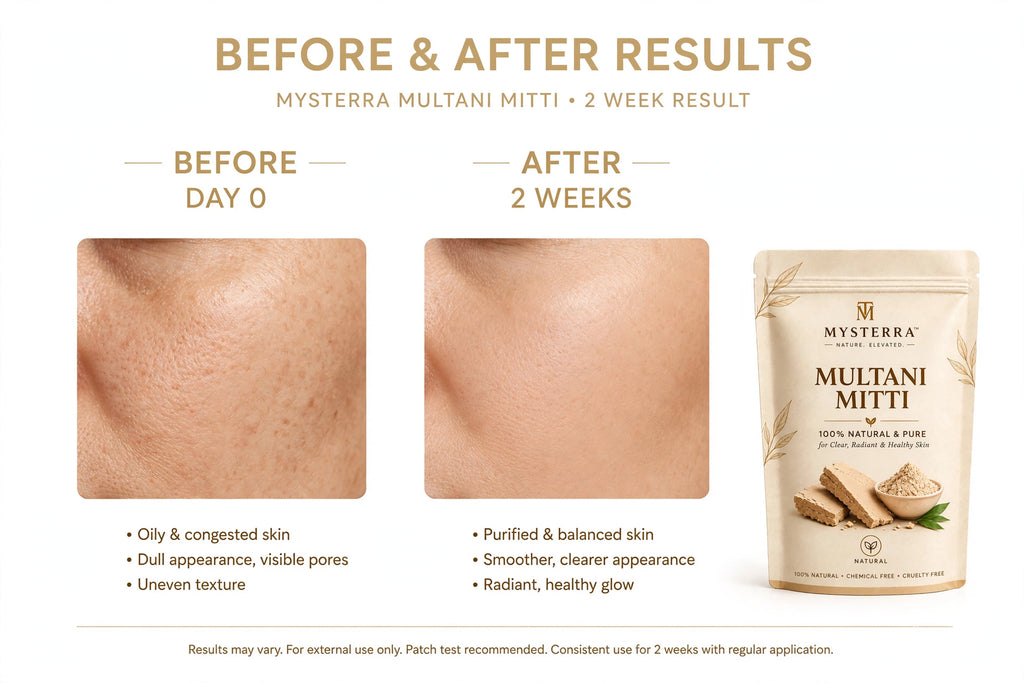MYSTERRA Multani Mitti Face Pack Powder – Pack of 4 × 75g (300g)
