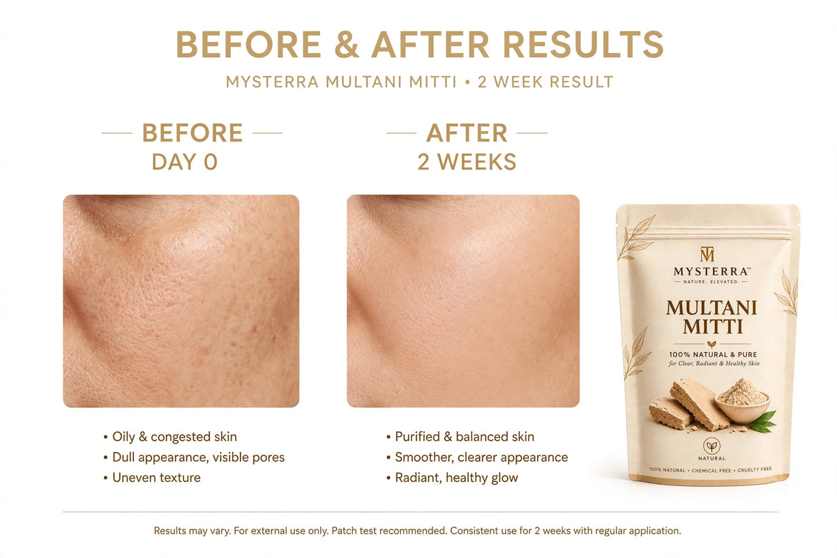 MYSTERRA 100% Natural & Pure Multani Mitti Face Pack Powder – Pack of 4 × 75g (300g)